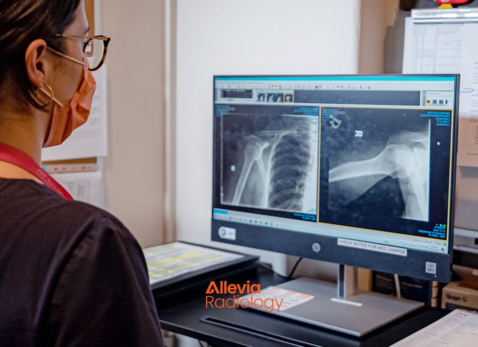 Allevia Radiology X ray